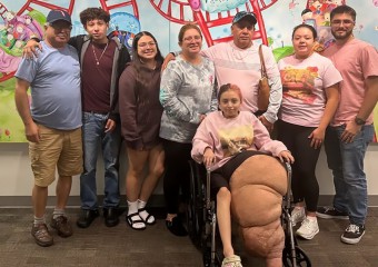 14-річній дівчинці у США ампутували ногу вагою 77 кг після рідкісного захворювання