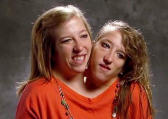 Найвідоміші сіамські близнючки стали мамами