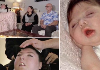 Жінка без мозку відсвяткувала новий день народження: їй не давали шансів на життя (фото)