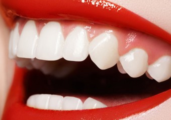 Що робити, щоб зуби були білими: поради стоматологів