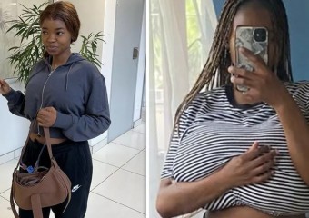 У жінки раптово збільшилися груди на п’ять розмірів: фото до та після