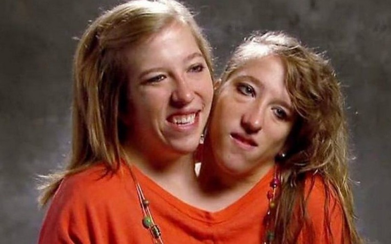 Найвідоміші сіамські близнючки стали мамами