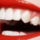 Що робити, щоб зуби були білими: поради стоматологів