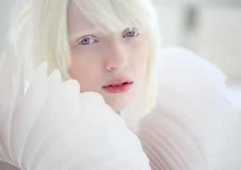 Снежная красота: невероятные альбиносы из разных стран